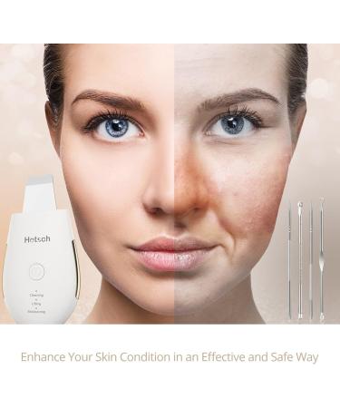 Hotsch Skin Scrubber Face Spatula - Ultrasonic Blackhead Remover and Pore Cleaner with 3 Modes - Rechargeable Facial Cleansing Tool - Buy Online on GoSupps.com
