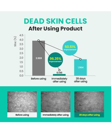 Real Barrier Porebium Peeling Toner 305ml - Exfoliating Toner for Oily & Sensitive Skin | Korean Skin Care | Sebum Control & Blackhead Remover - Buy Online on GoSupps.com