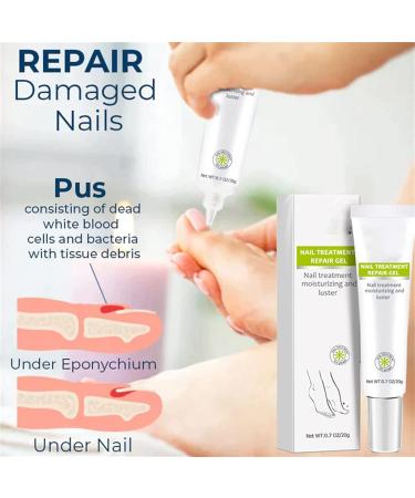  DUBUSH Narc Paronychia Repairing Nail Care Gel restores the appearance of discolored or damaged nails. Instant beauty gel. - Buy Online on GoSupps.com