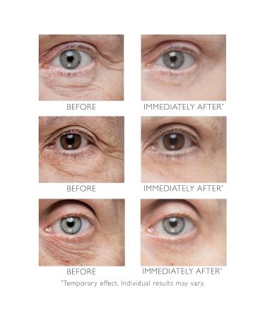 Peter Thomas Roth Instant FIRMx Eye Tightener 15ml - International Shipping | Reduce Puffiness & Dark Circles - Buy Online on GoSupps.com