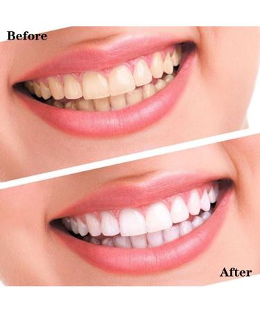 Advanced No-Slip Teeth Whitening Strips | Brighten Yellow & Stained Teeth Fast - Buy Online on GoSupps.com