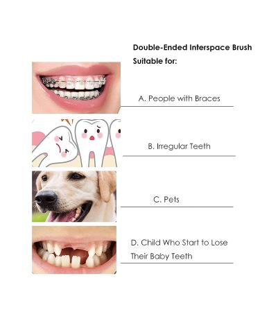 HRASY 4 Pieces Orthodontic Toothbrush Double-Ended Interspace Brush for Braces - Tiny Soft Trim Head - Teeth Detail Cleaning - 4 Colors - Buy Online on GoSupps.com