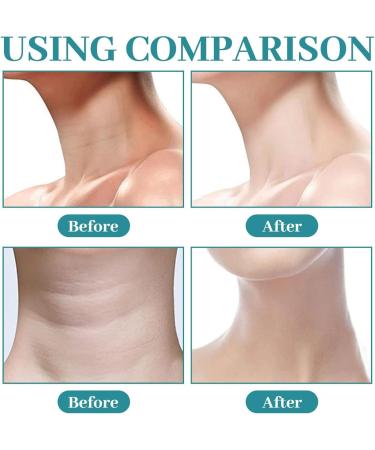 NRSW 3oz - Ultra Moisturizing Crepe Skin Firming Cream for Neck Chest Arms and Legs Advanced Body Repair Treatment 2pcs - Buy Online on GoSupps.com