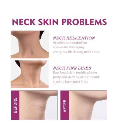 Hydrolyzed Collagen Neck Firming Cream - Anti-Aging Moisturizing Punish Cream for Youthful Necklines - Buy Online on GoSupps.com