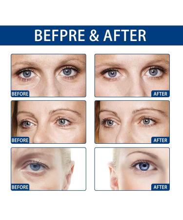 Jasmine Eye Ointment for Dark Circles & Puffiness | Premium Eye Care Cream - Buy Online on GoSupps.com