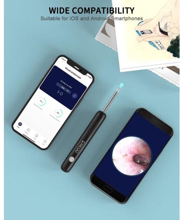 XKOO Ear Wax Removal Kit - 1080P FHD Otoscope & 6 LED Lights - Wireless Ear Camera - 8pcs Accessories - Multifunctional Black - Buy Online on GoSupps.com