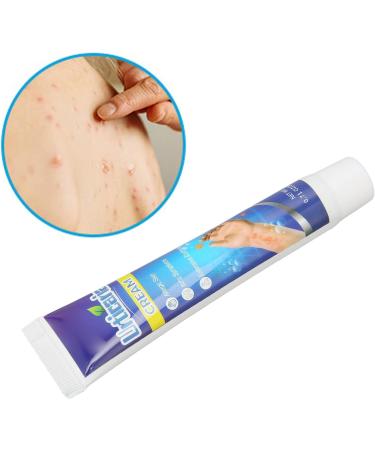20g Anti-Itch Cream for Urticaria & Pruritus | Adjunctive Treatment for Dry Skin | Soothes Hives & E45 Itch Relief - Buy Online on GoSupps.com