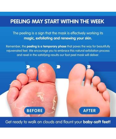 Pedicure Grade Foot Masks That Remove Dead Skin | Smooth and Soften Foot Peel mask for Dry Cracked feet Premium | Callus Removal | Imperial Feet - Buy Online on GoSupps.com