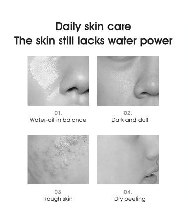 Aichun Beauty Vitamin E Oil & Hyaluronic Acid - Anti-Wrinkle Moisturizer for Skin & Hair - 115ml/3.89fl.oz - Hydrating & Nourishing - Buy Online on GoSupps.com