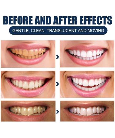 Aiposhiy Teeth Whitening Powder - Natural Mint Probiotic Tooth Cleaning Powder (3PCs) - Brighten Your Smile Naturally! - Buy Online on GoSupps.com