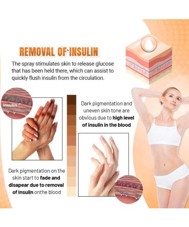DILUTE Acantho Clear Therapy Spray - Dark Knuckles & Acanthosis Nigricans Treatment (2PCS) - Buy Online on GoSupps.com