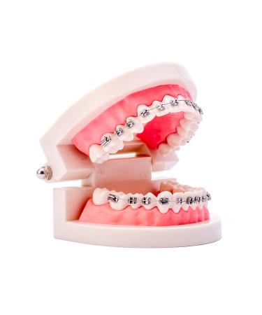 Buy Dental Orthodontic Standard Teeth Model with Metal Brackets & Wires - International Shipping Available - Buy Online on GoSupps.com