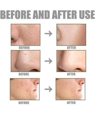 Mens BB Cream Foundation Face Tinted Moisturiser Mens Concealer Colour Correcting Cream for Cover Blemishes BB Cream Light with SPF15+ Even Skin Tone Face Cream Skin Tint Foundation Tinted Sunscreen - Buy Online on GoSupps.com
