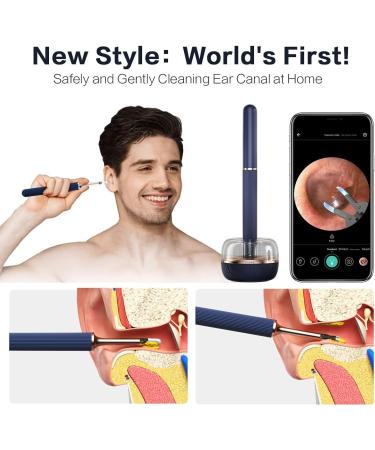 BEBIRD Ear Wax Removal Tool - Upgraded 10MP HD Camera 2-in-1 Tweezer & Rod WiFi Smart Ear Cleaner for iPhone & Android - Yellow - Buy Online on GoSupps.com