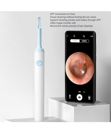 TUORE 1080P Ear Cleaning Camera with LED Light for iOS, WiFi Otoscope for Ear Wax Removal - APP Control (White) - Buy Online on GoSupps.com