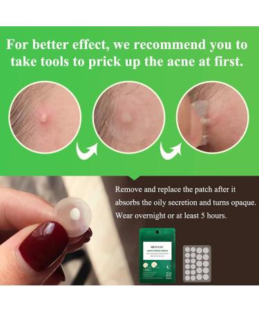 BREYLEE Acne Pimple Patch (66 Count) - Tea Tree Oil & Hydrocolloid Zit Healing Patch - 10mm+12mm - Pack of 3 - Buy Online on GoSupps.com