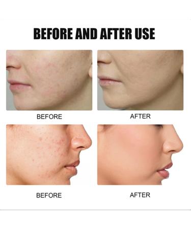 Rozino 3PC Face Serum Set | Advanced Collagen Boost Anti-Aging Solution for Glowing Skin - Buy Online on GoSupps.com