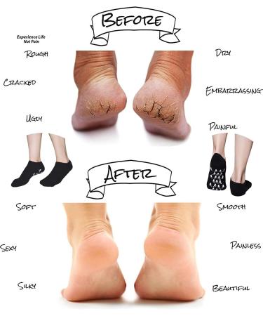 Men's Moisturizing Gel Spa Socks for Repairing Dry, Cracked Feet - Black - Buy Online on GoSupps.com
