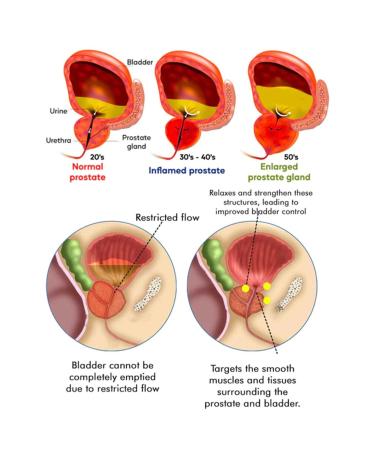 30ml Prostate Health Drops for Men | Supports Bladder Control & Urinary Health | Reduce Trips to the Bathroom | Natural Relief for Frequent Urination - Buy Online on GoSupps.com