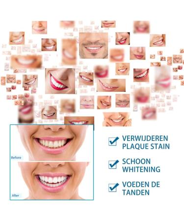 Teeth Whitening Pen 2 Pack - Effective Stain Remover Gel for Painless Whitening - Buy Online on GoSupps.com