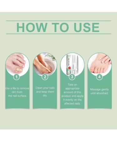 Lot de 4 stylos r parateurs d'ongles de qualit sup rieure - Traitement des ongles des orteils - Avec ingr dients naturels - S rum de soin des ongles pour les ongles endommag s s rs et efficaces pour 4 pi ces - Buy Online on GoSupps.com