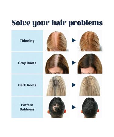 SuperSize Color Fibers Refill Set - Light Blonde Hair Thickener | Temporary Root Touchup & Hair Fiber Powder | International Shipping Available - Buy Online on GoSupps.com