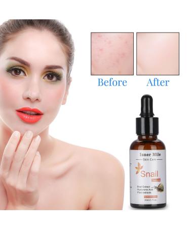 Snail Repair Eye Cream | Anti-Aging Essence Serum for Face & Eyes | Moisturizing Dark Circle Reducer with Snail Mucus Extract - Buy Online on GoSupps.com