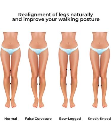 4 Pairs BodyFeet Aligners Kit - Orthopedic Bunion Corrector Gel & Toe Ring for Foot Shape Correction - Buy Online on GoSupps.com