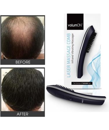 Hair Growth Brush VOLUMON Hair Growth Treatment Laser Device to Help Prevent Further Hair Loss and Promote Hair Regrowth - Infrared Vibrating Massager with LCD Display for Men & Women - Buy Online on GoSupps.com