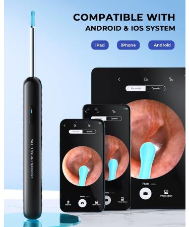 KAUGIC Ear Wax Removal Kit with 1080P Camera and 8 Pcs Ear Set - Otoscope with Light for iPhone & Android - Black Polypropylene - Buy Online on GoSupps.com