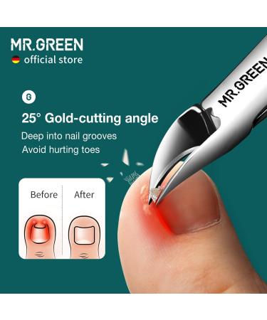 MR.GREEN Anti-Splash Toe Nail Clippers - Professional Pedicure Tool for Ingrown & Thick Nails - Blue Handle - Buy Online on GoSupps.com