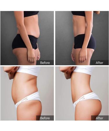 Losing Weight Patch - 60 Slim Stickers for Belly Fat & Anti-Cellulite | Fast Non-Irritating Fat Burning Solution - Buy Online on GoSupps.com