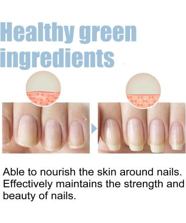 Nail Growth And Repair Serum Nail Growth and Strengthening Serum Nail Serum Repair Essence Strengthening Polish Nail Serum Restored Nail Strength and Reduced Peeling (1pc) - Buy Online on GoSupps.com