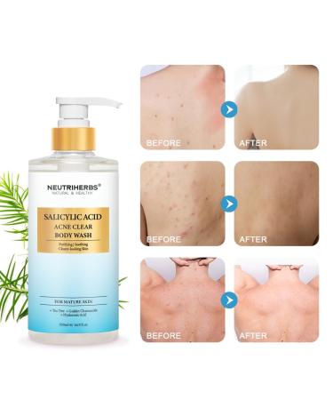 Neutriherbs Acne Body Wash - Anti-Acne Shower Gel with Salicylic Acid Grapefruit Scent - For Men & Women - 16.9 Fl.Oz - International Shipping Available - Buy Online on GoSupps.com