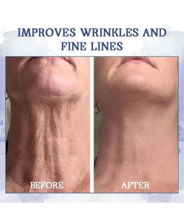 Advanced Firming & Anti-Wrinkle Cream Deep Hydration for Sagging Sun-Damaged Skin (2pc) | Rejuvenate & Restore Your Skin - Buy Online on GoSupps.com