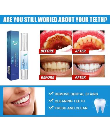 Shop Limetow Teeth Whitening Essence - Ultimate Tooth Whitening Pen & Gum Therapy Gel (2PCs) | Global Shipping Available - Buy Online on GoSupps.com