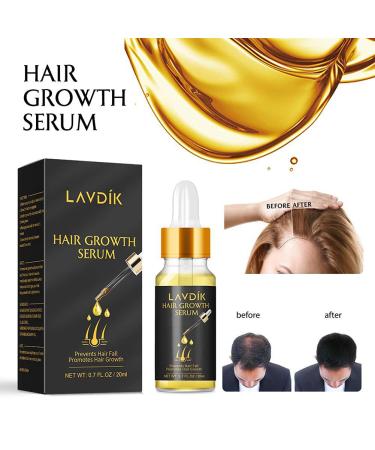 Biotin Thickening Herbal Serum - Fast Hair Growth Essence Oil | Prevent Hair Loss & Thinning for All Hair Types (3 PCs) - Buy Online on GoSupps.com