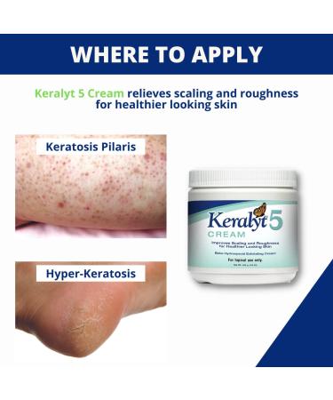 Keralyt 5 Psoriasis Cream - 5% Salicylic Acid Exfoliating Lotion for Full Body Relief - Buy Online on GoSupps.com