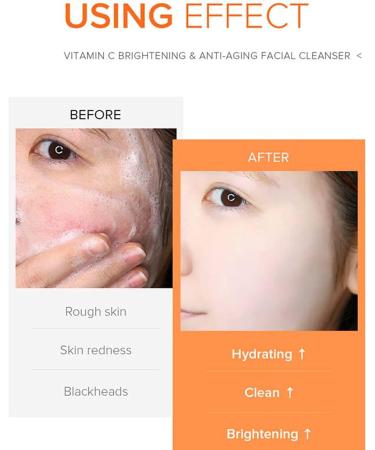 Vitamin C Facial Cleanser for Brightening & Hydrating | Gentle Face Wash for Dry & Sensitive Skin | Moisturizing Formula with Vitamin C for Natural Radiance - Buy Online on GoSupps.com