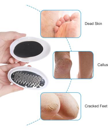 Creative Egg Foot Grinder Portable Egg Callus Remover Egg Shape Foot Scrubber Perfect for Foot Spa Egg Shaped Foot Scrubber Home Salon and Removing Tough Calluses and Dry Skin - Buy Online on GoSupps.com
