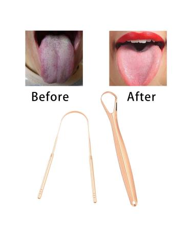 2-Piece Tongue Scraper Set for Fresh Breath | Gold Mouth Care Tools - Shop Internationally - Buy Online on GoSupps.com