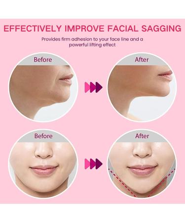 V Line Face Lifting Chin Mask Chin Lift Mask V Shape Face Tape for Wrinkles Face Lift Tape Neck Lift Tape Face Masks Beauty Skin Tightening Face Mask Chin Strap for Double Chin Reducer Firming - Buy Online on GoSupps.com
