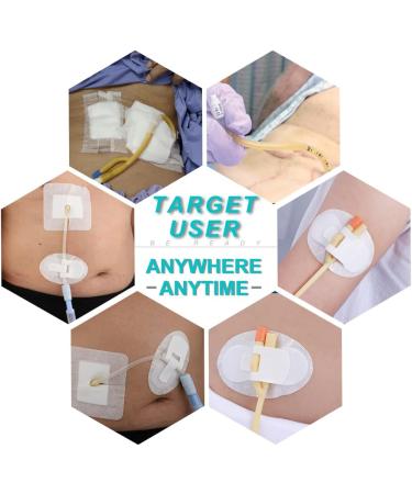 Peritoneal Dialysis PD Catheter Holder Adhesive Patch | Stabilization Device for Medical Tubes | Non-Woven Dressing | Pack of 5 - Buy Online on GoSupps.com