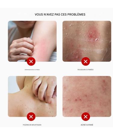 Cr me Anti-D mangeaisons | Soin Apaisant 20g Baume Absorption Rapide pour Peau Mixte Grasse Sensible R cup ration Post-Sportive Ext rieur - Buy Online on GoSupps.com