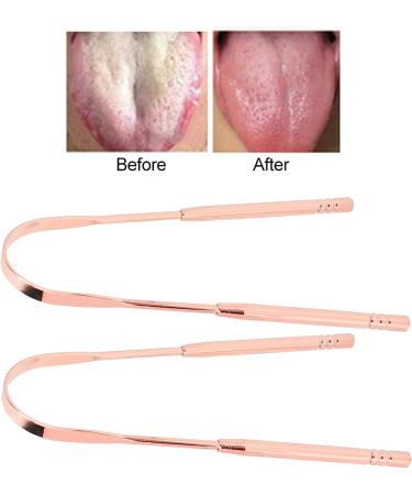 U-Shaped Stainless Steel Tongue Scraper Set - 2 Pieces for Oral Hygiene & Bad Breath Treatment | Perfect for Adults & Kids - Buy Online on GoSupps.com