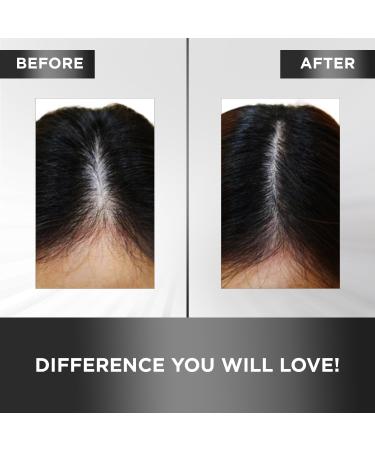 MOEHAIR Hair Tonic | Scalp & Hair Health | Follicle Stimulator | Volumizing Formula with Argan Oil & Ginseng | Paraben & Sulfate Free | 4 Fl. Oz - Buy Online on GoSupps.com