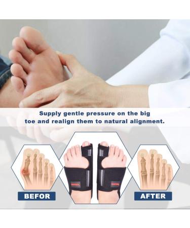 Bunion Corrector Splint for Men and Women - Orthopedic Relief for Big Toe Pain - Hallux Valgus Corrector - Black, One Size - Buy Online on GoSupps.com