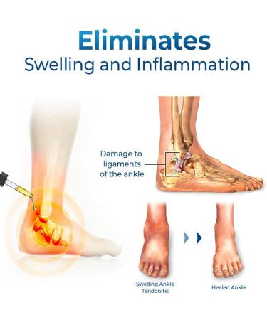 Ankle Therapy Oil for Pain Relief and Swelling Treatment - Joint & Muscle Pain Relief Gel for Swollen Feet and Ankles - Buy Online on GoSupps.com