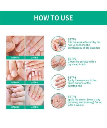 2Pcs Kerassentials Toenail Fungus Treatment - Healthy Skin, Hair & Nails Formula - Buy Online on GoSupps.com