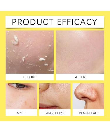 Kojic-Acid and Turmeric Pads 110 Turmeric Kojic-Acid Cleansing Pads Turmeric Face Exfoliatings Pads Moisturizing Kojic-Acid Foaming Pads Facial Sponges for Women Skin Care - Buy Online on GoSupps.com